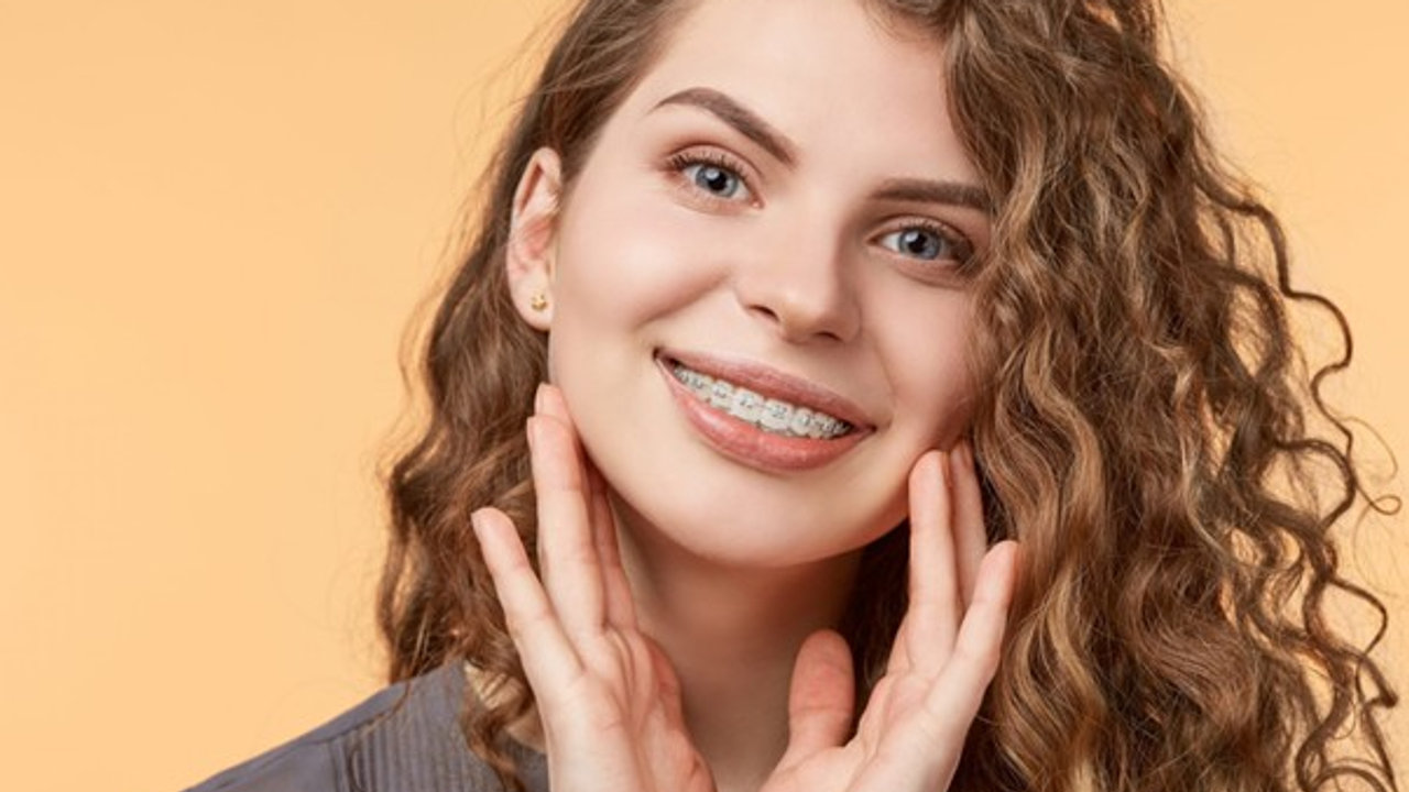 How Do Ceramic Braces Differ from Traditional Braces?