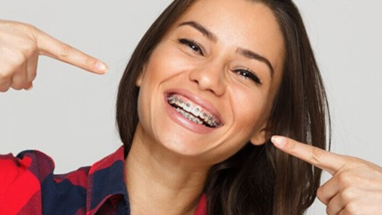 How Long Will I Have to Wear Orthodontic Braces?