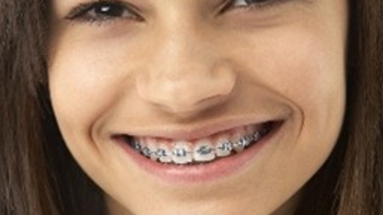 How to Care for Your Braces