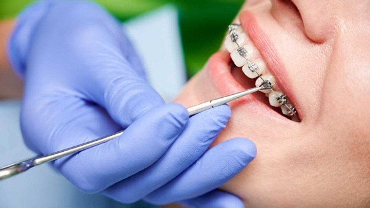 What Does An Orthodontist Do?
