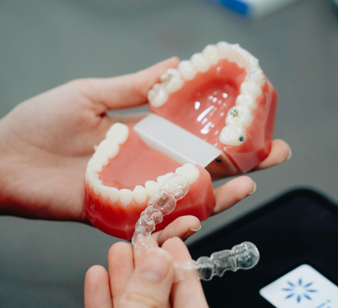 A clear aligner tray held between finger and thumb