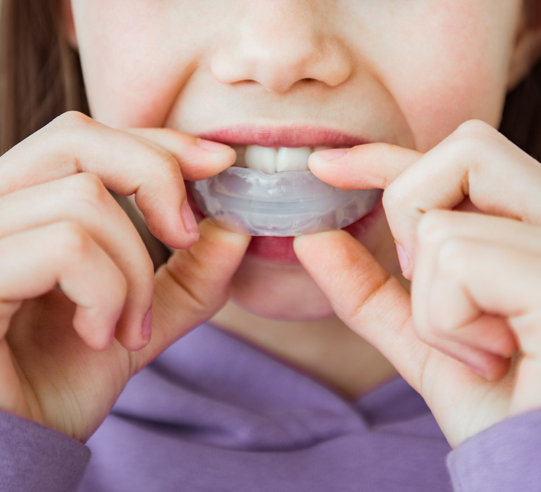 A functional appliance used to modify jaw growth